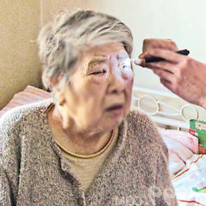 呼和浩特市免费为65岁以上老人治疗白内障
